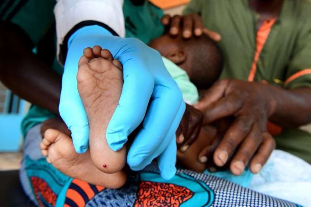 VIH pédiatrique au Gabon : seuls 700 enfants identifiés sur 2 400 attendus